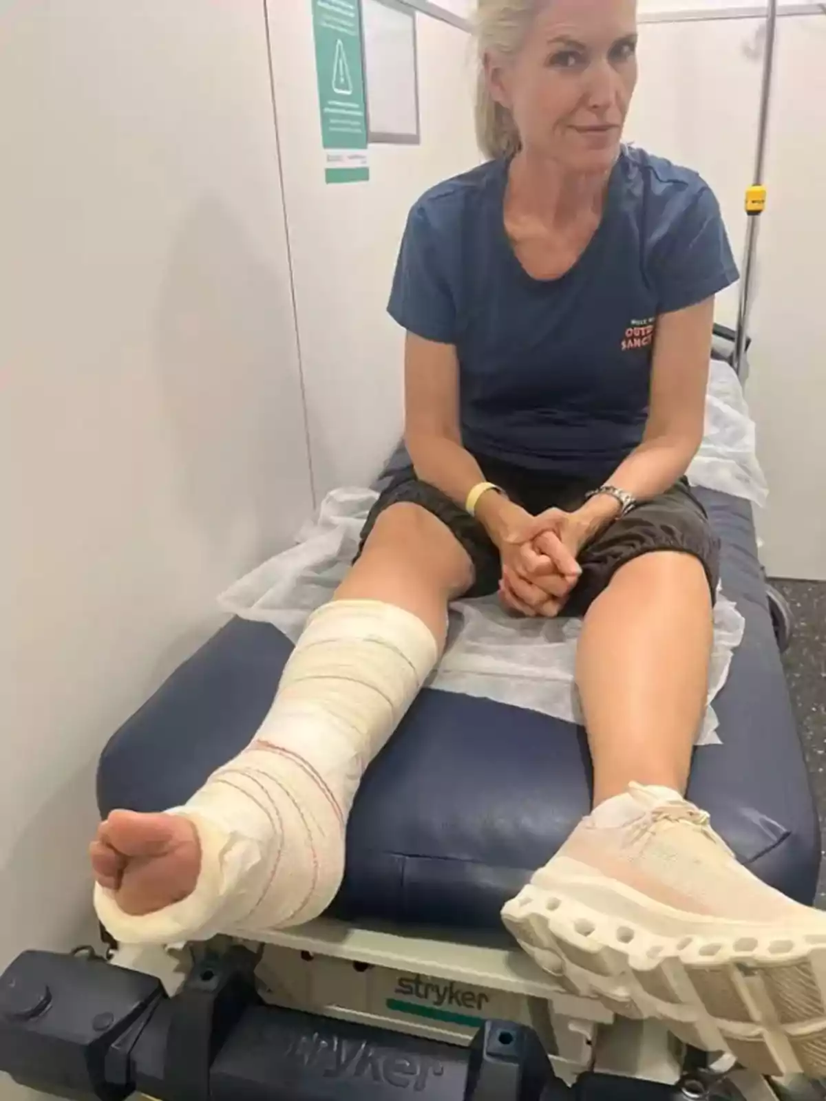 Dona asseguda en una llitera d’hospital amb una cama embenada i expressió seriosa Dona asseguda en una llitera d’hospital amb una cama embenada i expressió seriosa