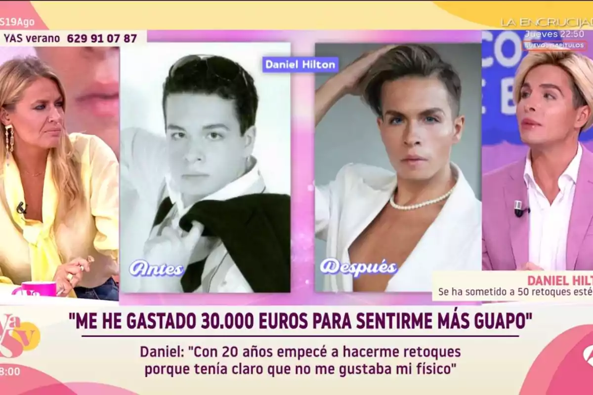 En un programa de televisió, es mostra una comparació de l’abans i el després d’un home que ha gastat 30.000 euros en retocs estètics, acompanyat d’una presentadora i el mateix convidat parlant sobre la seva experiència.