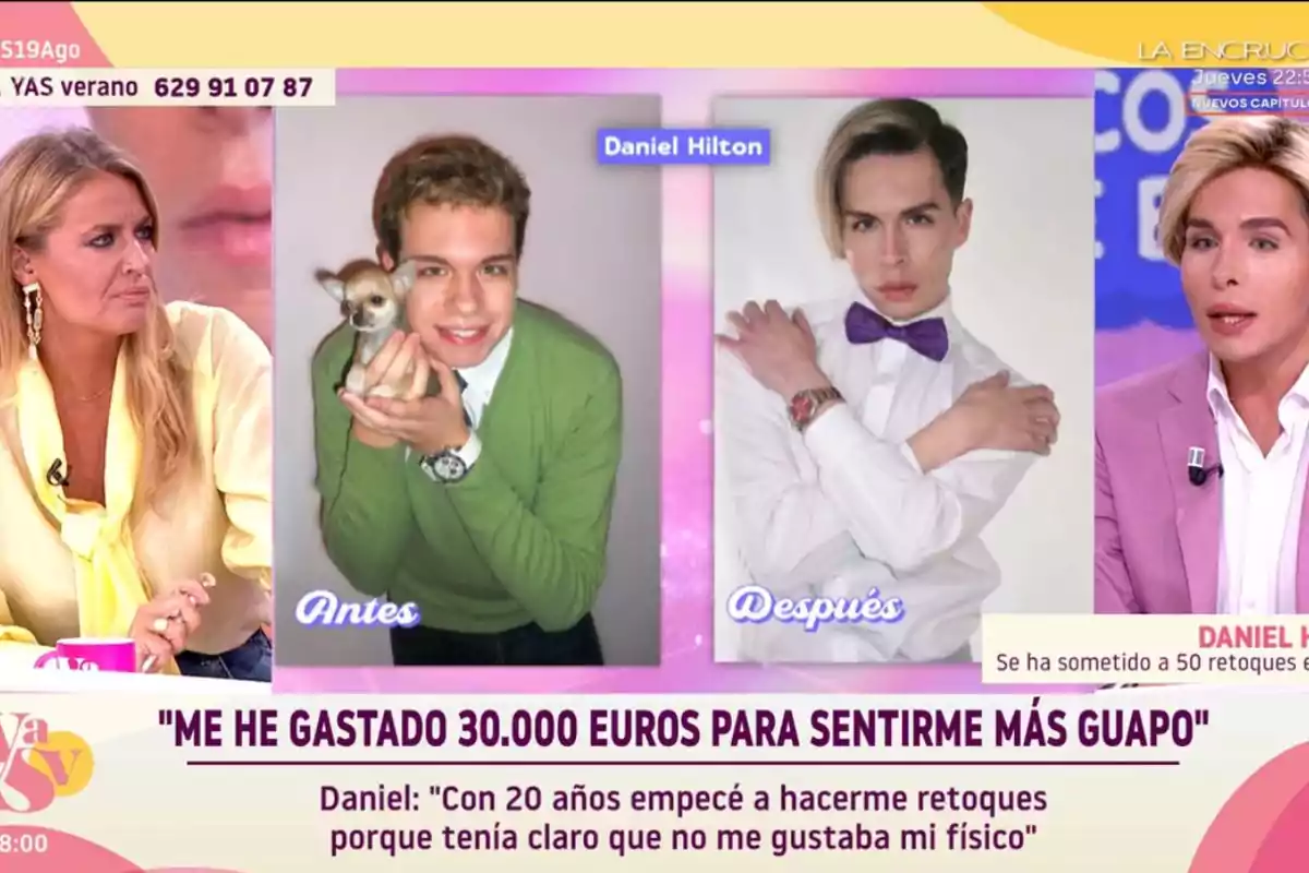 En un programa de televisió, una presentadora entrevista un jove que mostra la seva transformació física amb fotos d’abans i després, acompanyades d’un text que menciona la despesa de 30.000 euros en retocs estètics per sentir-se més guapo.