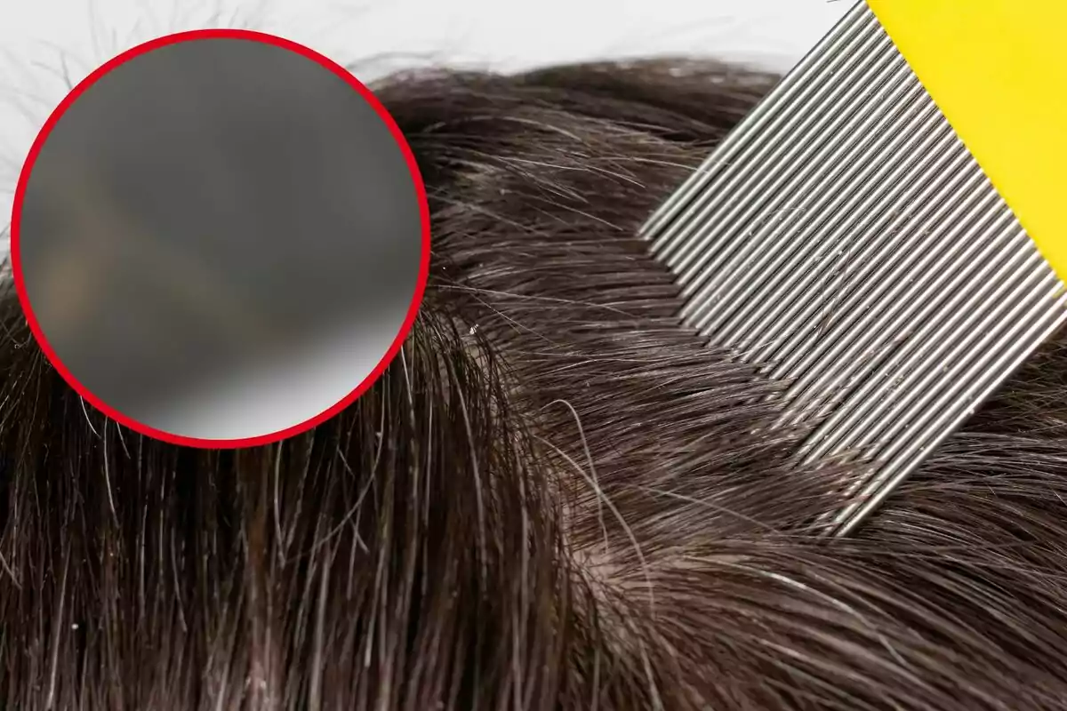 Peine metálico pasando por el cabello para eliminar piojos y liendres.